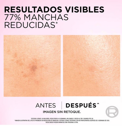 Rutina Anti-Manchas L'Oréal Glycolic Bright Gel 150 ml + Serum 30 ml + Crema 50 ml - .